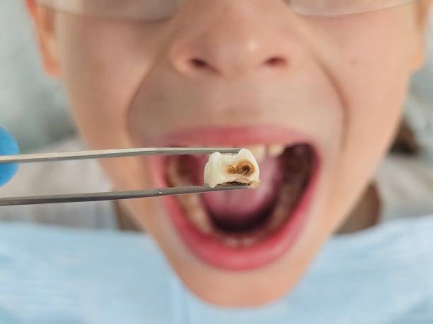 Best Emergency Orthodontic Services in Killian, LA